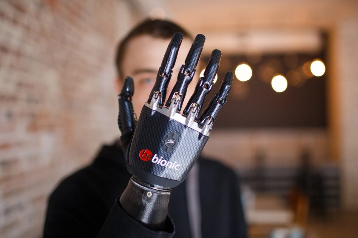 на фото бионическая рука BeBionic, эта же компания недавно анонсировала создание "электронной кожи", позволяющей ощущать ее владельцу обратную связь от протеза.