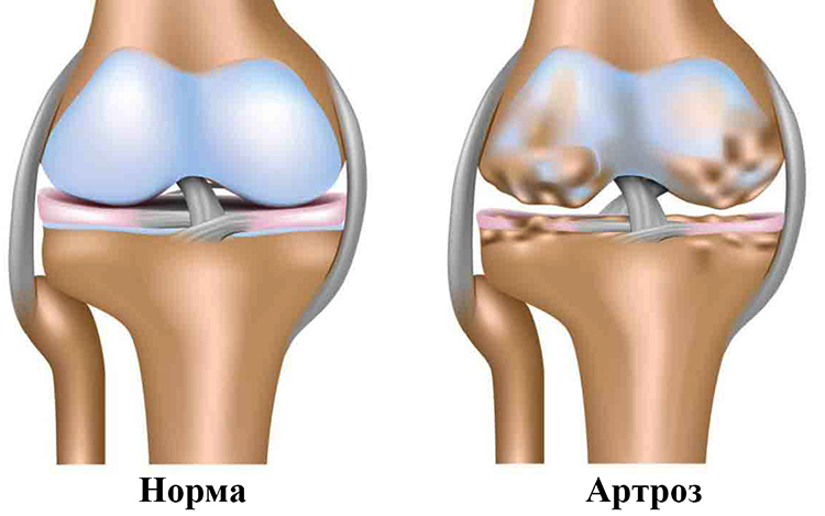 Источник: sustavos.ru