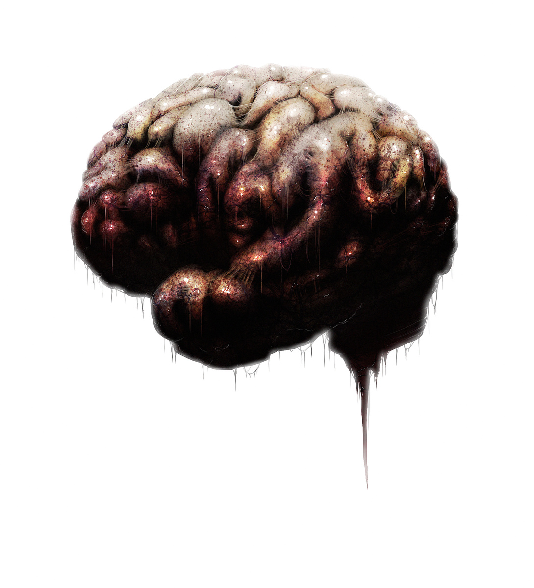 Поврежденный мозг