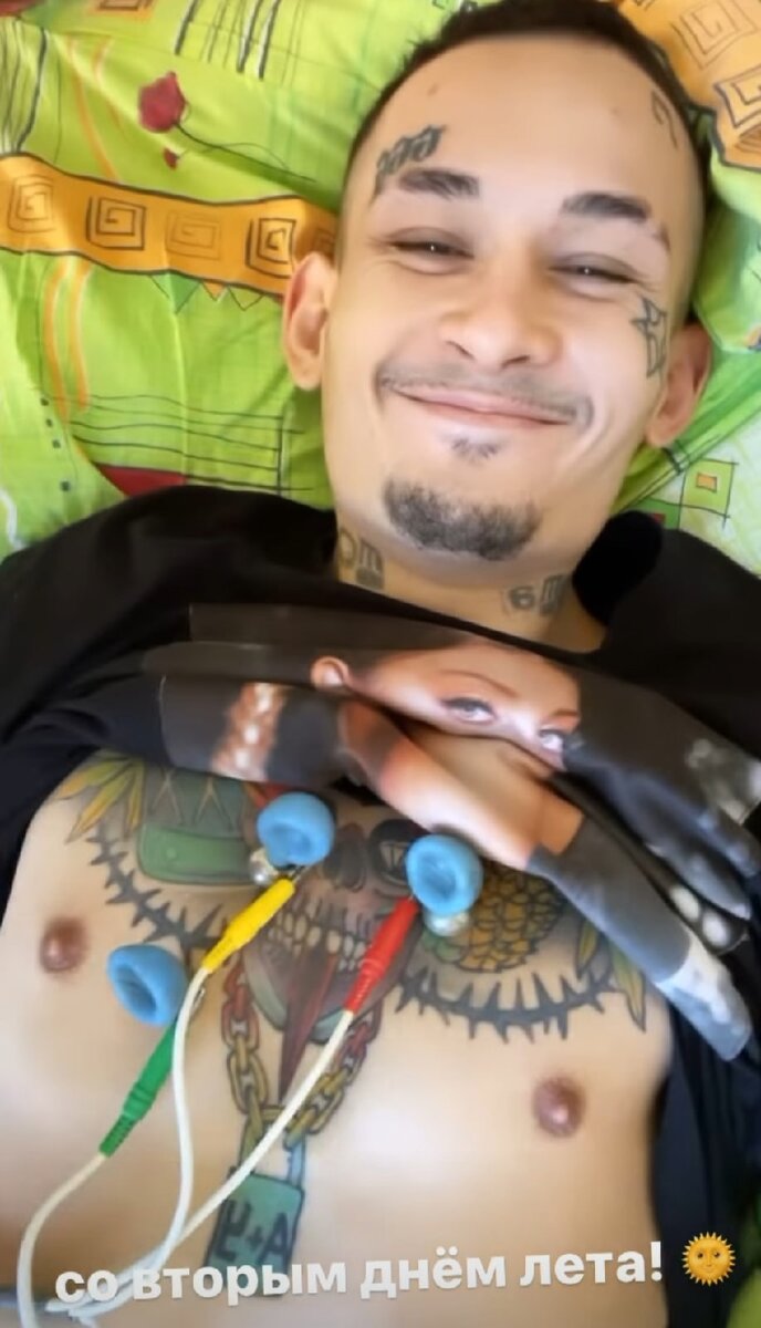 -2