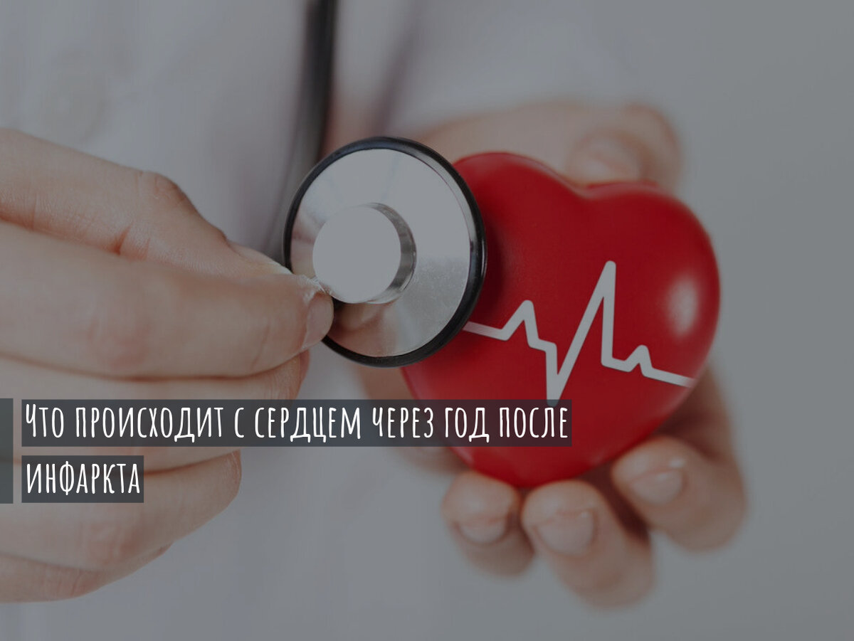 Что происходит с сердцем через год после инфаркта.
