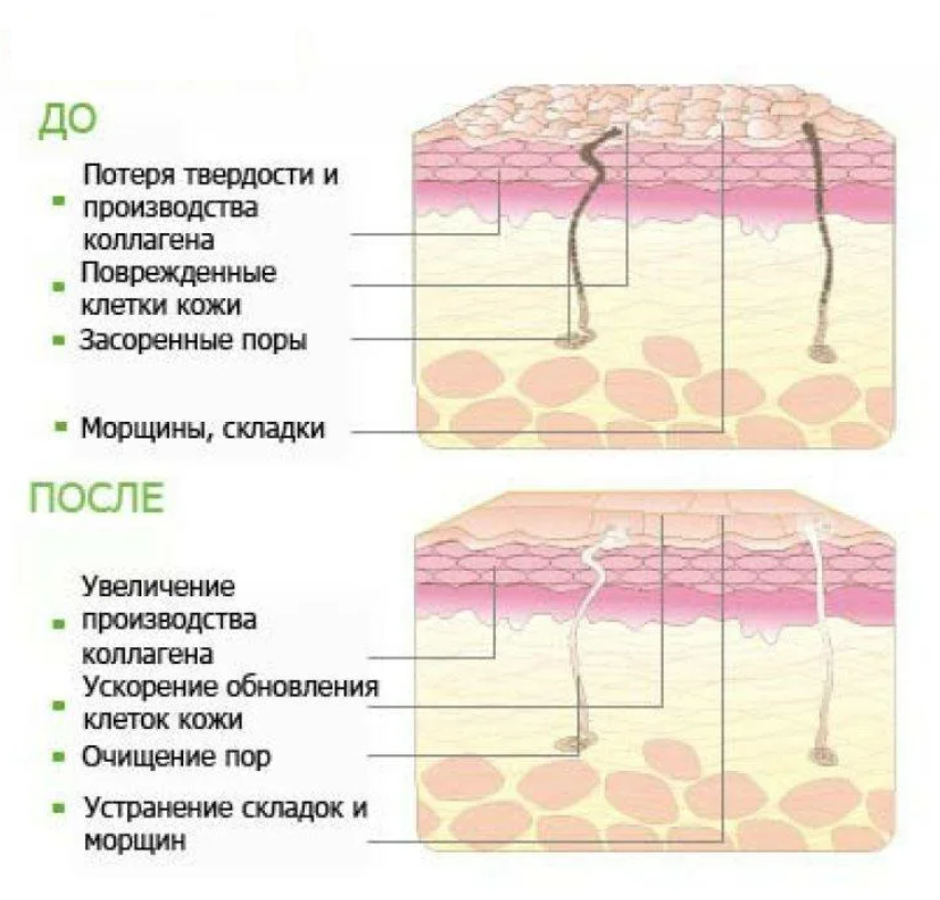 Как ретинол влияет на кожу. Пилинг по глубине воздействия. Отшелушивание рогового слоя эпидермиса кожи схема. Воздействие пилингов на кожу.