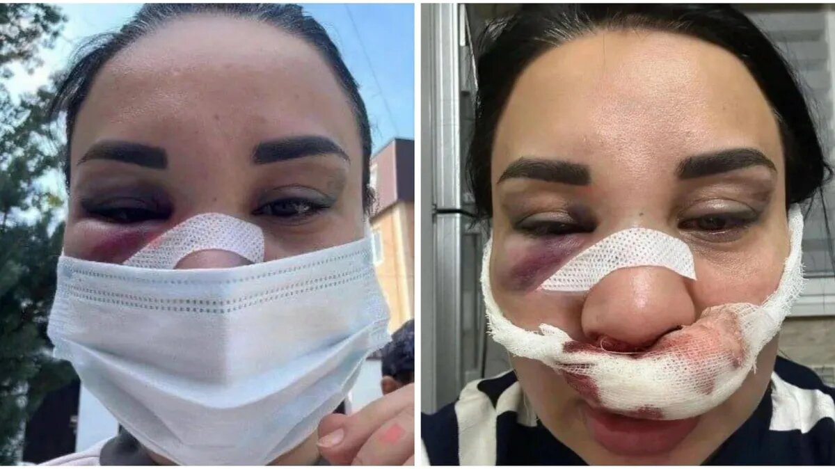 Фото: Telegram-канал @goryachien