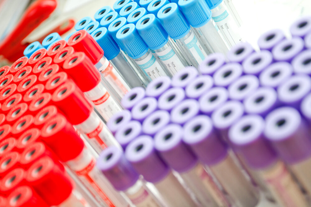 Пробирки для общего, гормонального и биохимического анализа крови маркируются разными цветами.
