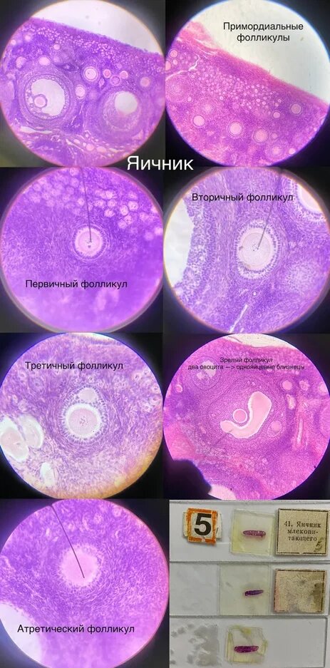 Вот например срез яичника. Окраска: гематоксилин-эозин.