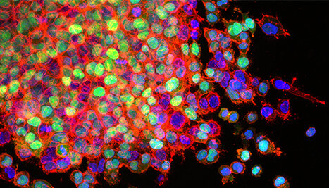 Иллюстрация: ccr.cancer.gov