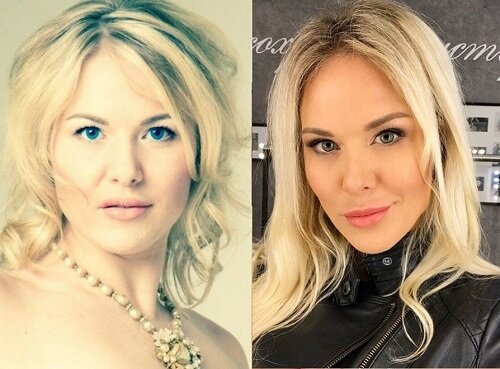 Ирина Мещанская: Новая (шестая) жена Шпака любимица лучших пластических клиник Р