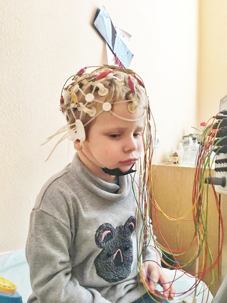Ээг головы ребенку. РЭГ И ЭЭГ. Энцефалограмма головного мозга. Электроэнцефалография (ЭЭГ). Электроэнцефалография у детей.