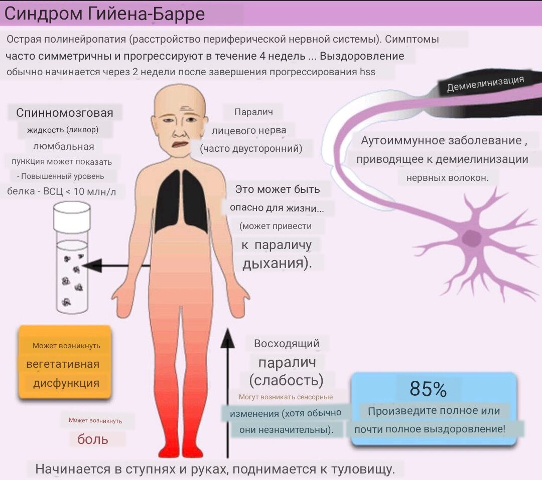 Гийена Барре заболевание. Полинейропатия Гийена Барре. Синдром Гийена Барре презентация.