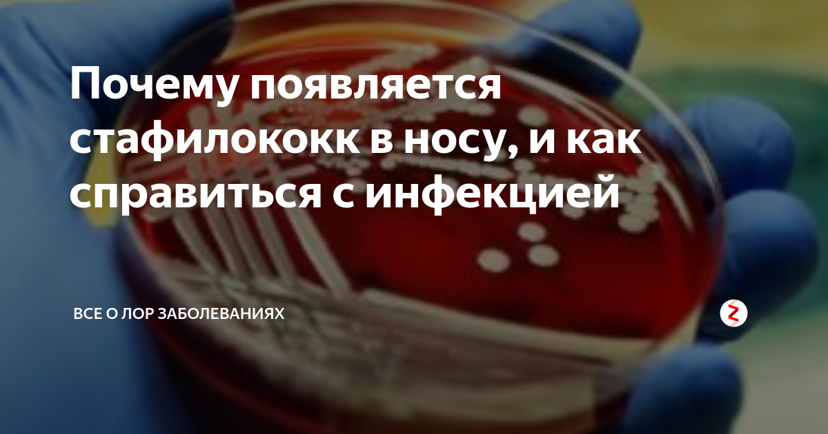 Как избавиться от стафилококка навсегда. Стафилококк aureus в носу. Золотистый стафилококк в носу.