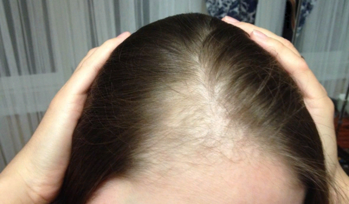 Спасибо, что зашли на канал. Подписывайтесь, у нас много полезных советов