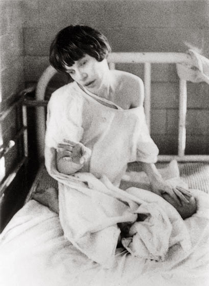 Думаю, после лоботомии это уже не жизнь. Это существование 