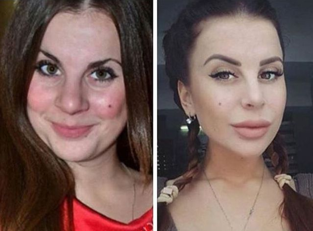 Красота - дело наживное. Звезды до и после пластики, часть 2 GNgirl Дзен