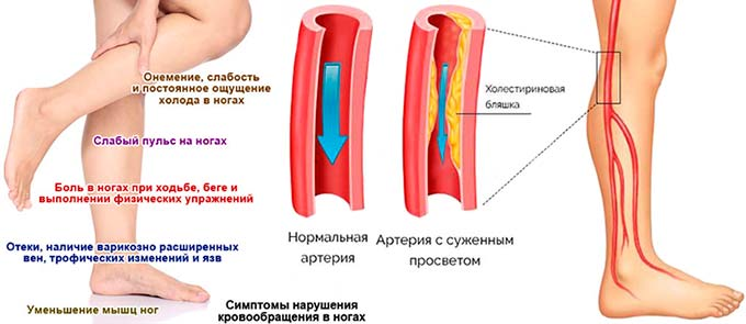 Не чувствует левая нога. Измерение артериального давления на ногах показатели ад в норме. Сосудистые заболевания ног.