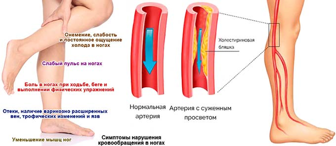 Резко онемела нога. Измерение артериального давления на ногах показатели ад в норме. Сосудистые заболевания ног.