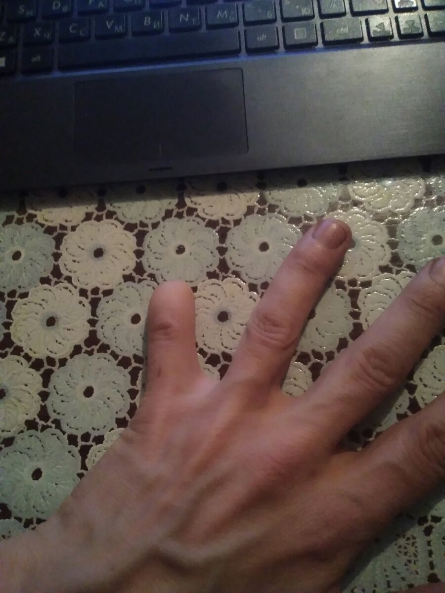 Видите? Пальца нет! Ну пол пальца:).. И все дело в несоблюдении правил по технике безопасности, которая между прочим пишется чьей то кровью..