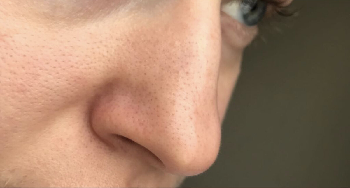 Фото ДО. Первый раз пробовала эту маску.