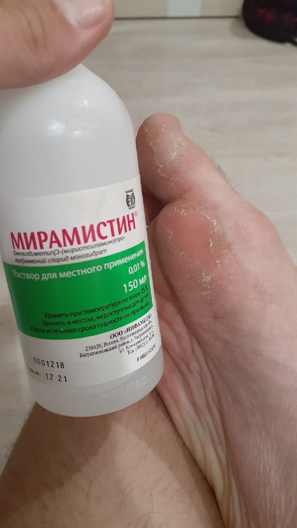 Покраснение сошло, так как я успел обработать  и спокойно добраться до дома.