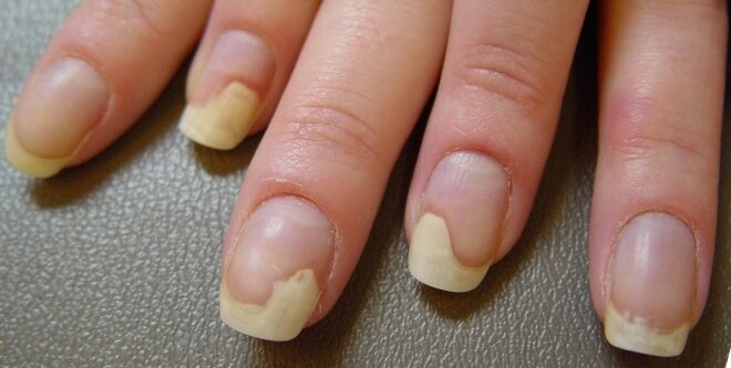 Не судите строго фото взяла из открытых источников (не было времени искать пример из своей практики, да и не зачем)