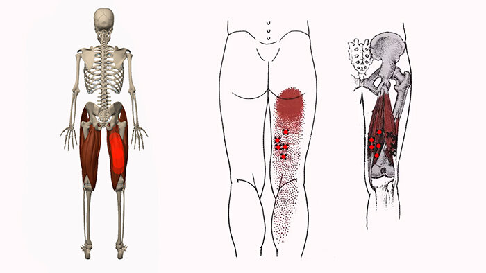 Точки мышц бедер