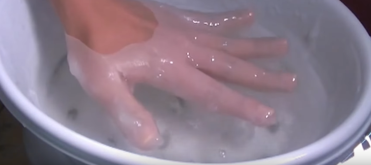 Морщины на пальцах рук как избавиться