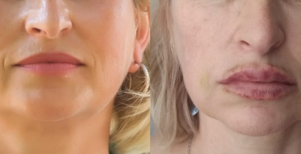 пластический хирург губарева. пластический хирург губарева. алёна верди пластический хирург. лияна юрьевна. пластический хирург губарева.