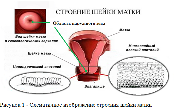 Эндометриоз: как диагностировать и лечить - Klinik.by