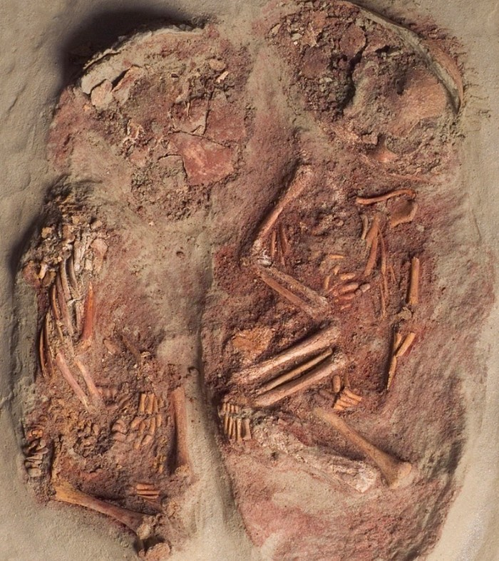 Захороненные однояйцевые близнецы. Слева новорождённый, справа его брат-близнец, умерший немногим позже