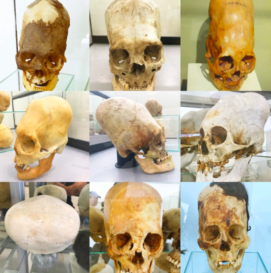 Изображение взято с сайта: https://megalithicmarvels.com/2018/02/03/new-dna-results-released-from-the-paracas-elongated-skulls/