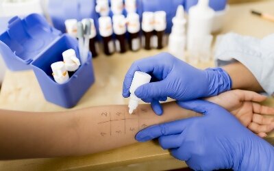 Кожный тест