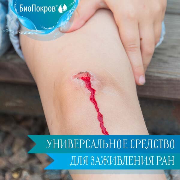 Гель Биопокров - универсальное средство для заживления ран