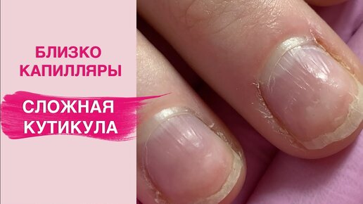 Сложная кутикула | Боязнь каждого мастера маникюра