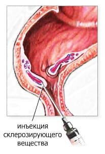 Лекция «Пиявки – чудо природы и доктор широкого профиля» в лектории «Университет здоровья»