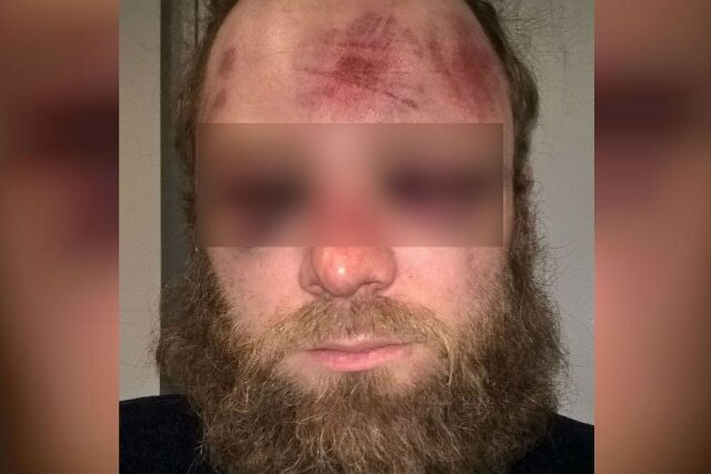 Аниматор Василий Базаров после нападения.