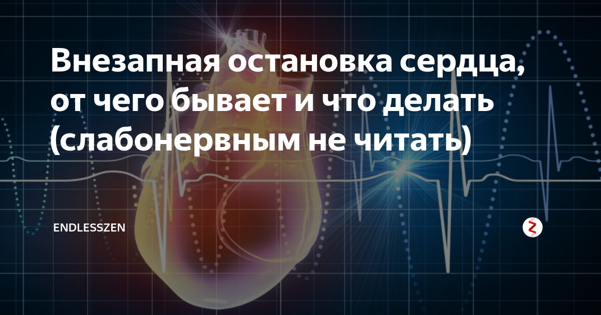 Внезапно останавливается сердце. От чего может остановится сердце. Почему может остановится сердце. Как останавливается сердце у человека.