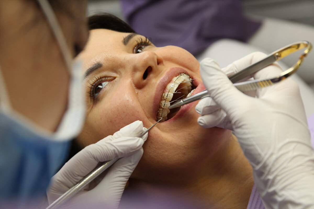 Техника Многопетлевой дуги в клинике Colibri Dental