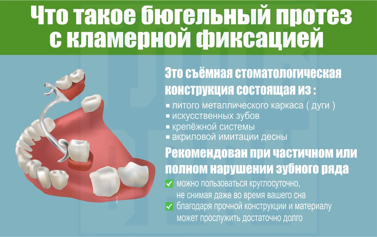 Составные элементы бюгельных протезов презентация