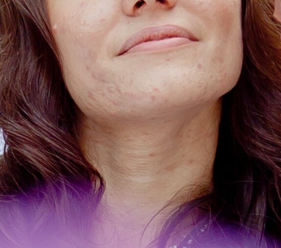 That's my wedding, I'm 23. My poor photographer must have spent hours and hours retouching my skin. :D Sorry .:D