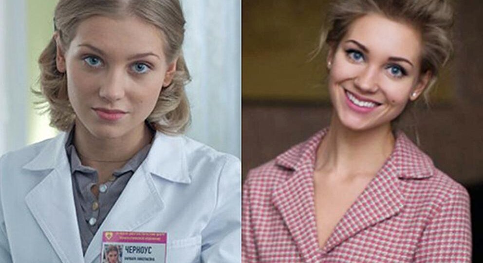 Кристина Асмус до и после пластики