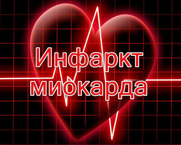 Инфаркт миокарда смешные картинки