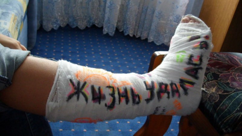 Это не моя нога. На моей были нарисованы хуи, и какой я лошара, раз так сломал ногу.