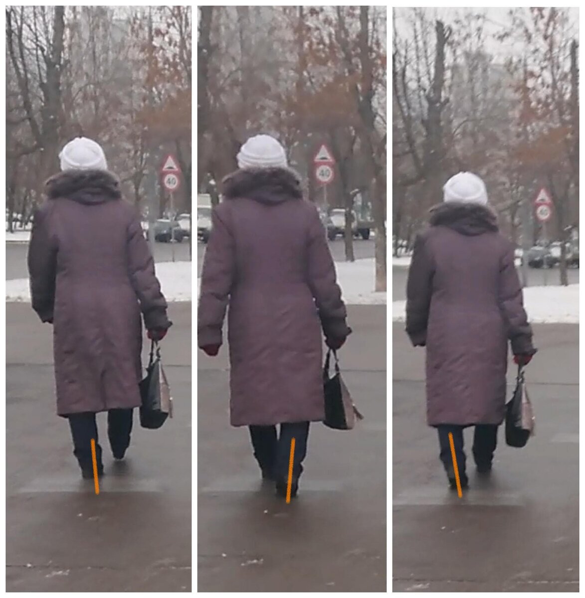 Стопа приходит в контакт с поверхностью внешним ребром, первое касание стопы идёт по всей поверхности пятки, я предполагаю, что каблук будет сношен достаточно равномерно, чуть больше снаружи.  