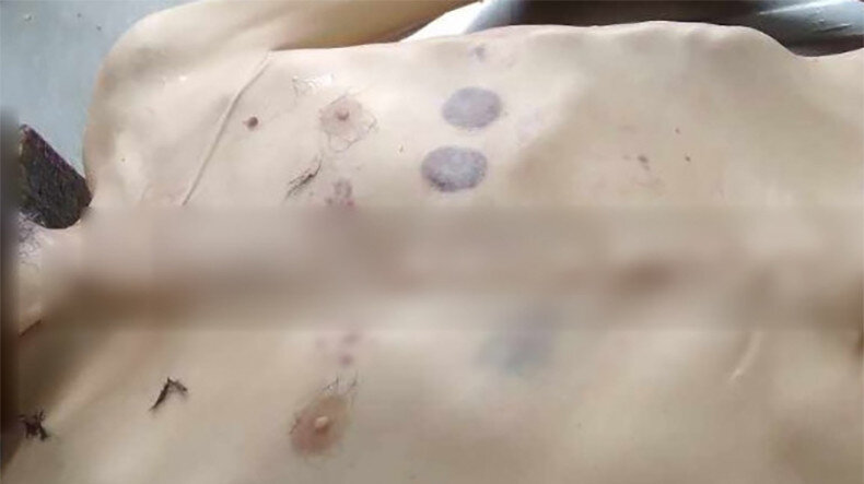 Защитник прав человека Республики Арцах (Нагорно-Карабахской Республики, НКР) Гегам Степанян пишет: «Согласно информации, полученной Офисом Защитника прав человека (ЗПЧ), и исследованиям, проведенным