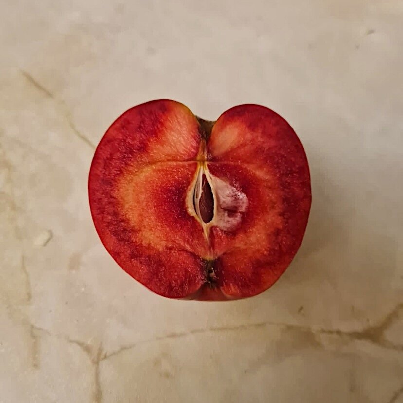 Такое яблоко попалось коллеге в отделении. Назвали его «гематологическим»