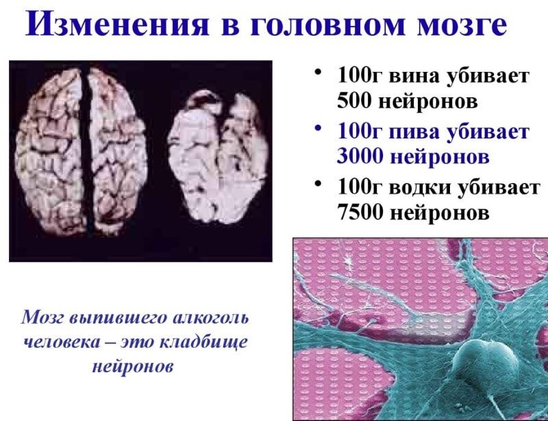  Недавно дочка спросила- а почему у многих людей болит голова после веселья?-2