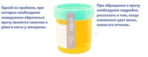 Моча ярко желтого цвета: что означает, причины