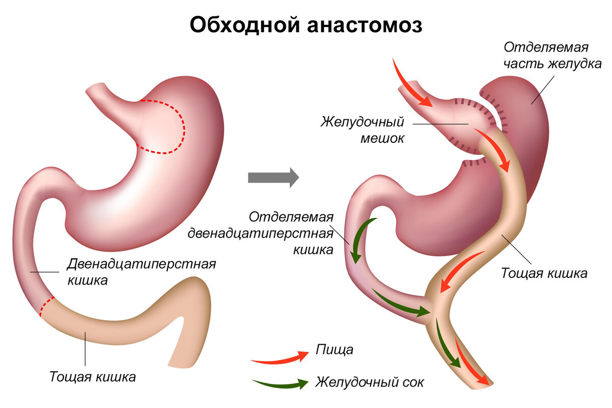 Чувство голода после стула