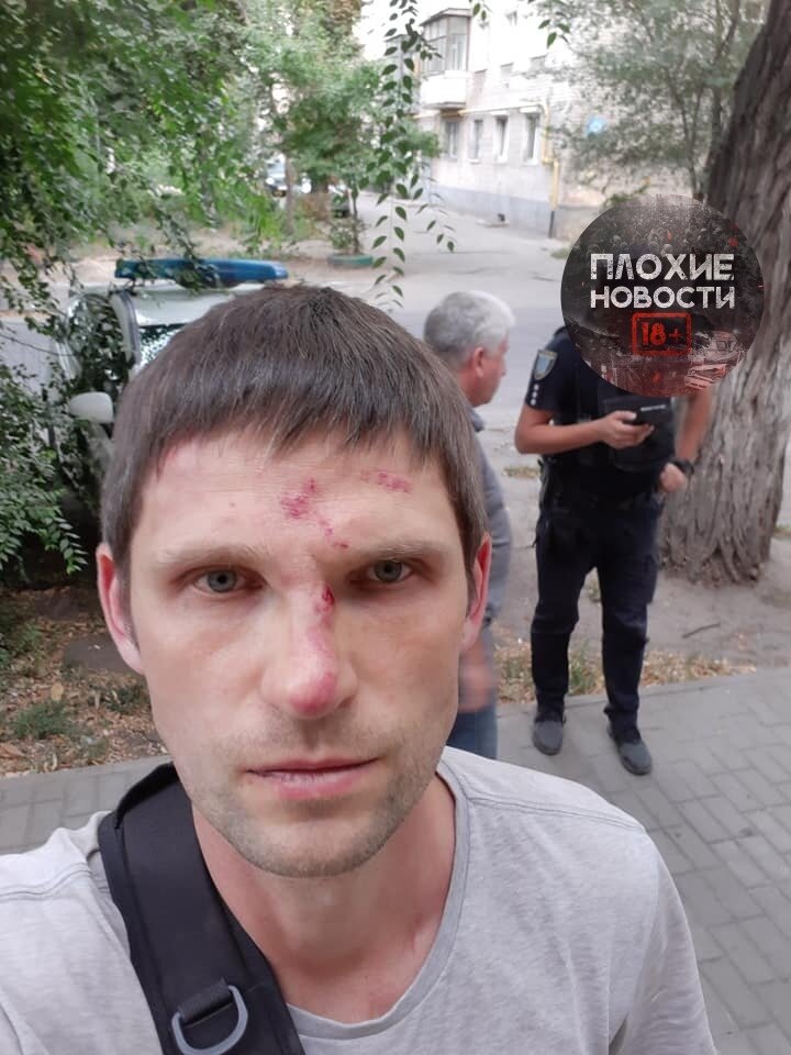 Позавчера (05-09-2018) неизвестные избили волонтера Олега Чистопольцева, прогуливавшегося по улице. Олег переходил дорогу в прекрасном настроении, которое не понравилось стоящему на светофоре водителю автомобиля Skoda:
  - Ты чё улыбаешься? 





