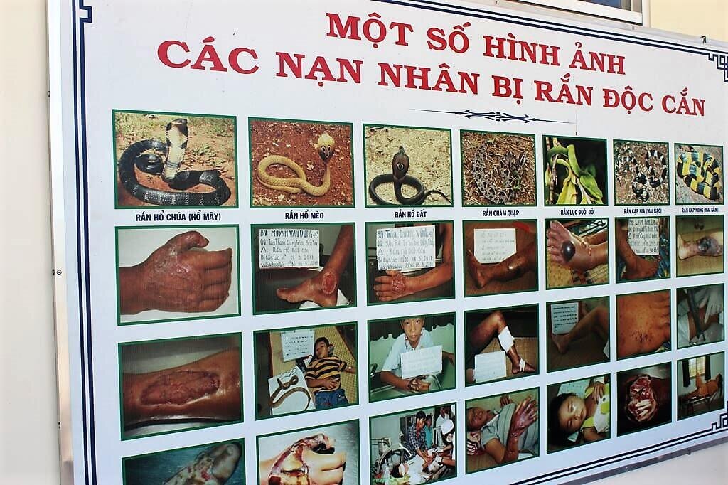 Последствия укусов ядовитых змей