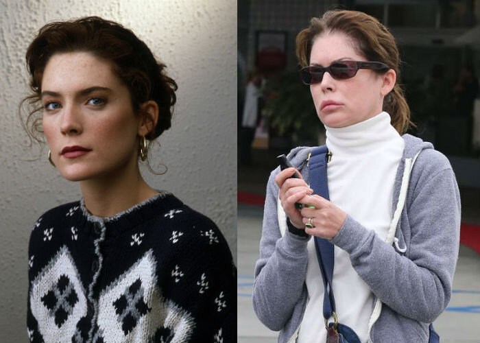 Лара Флинн Бойл  до и после операций 